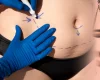 Plano de Saúde Cobre Cirurgia Plástica? Descubra Aqui com o Escritório Vaz & Oliveira!