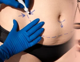 Plano de Saúde Cobre Cirurgia Plástica? Descubra Aqui com o Escritório Vaz & Oliveira!